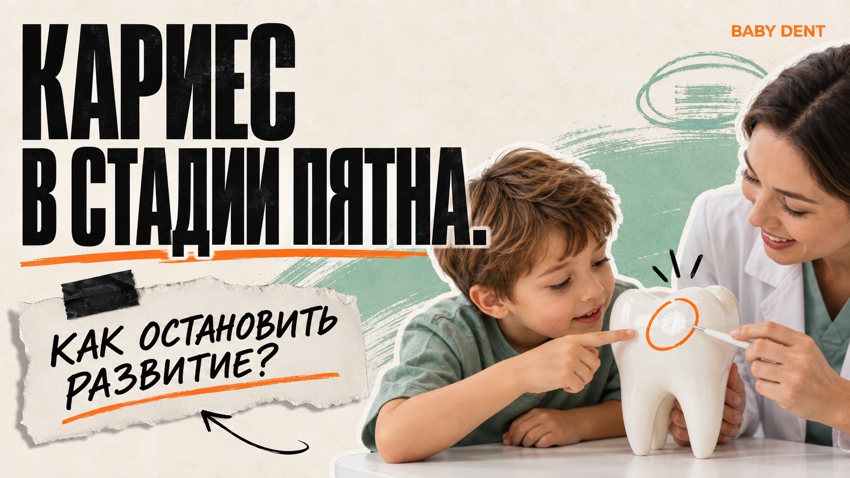 Кариес в стадии пятна. Как остановить развитие?| БЭБИ ДЕНТ