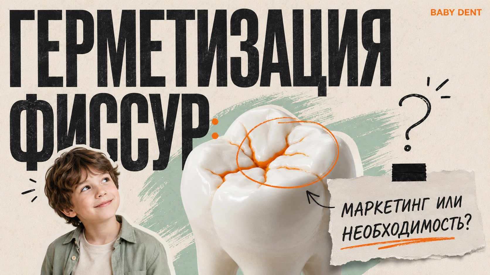 Герметизация фиссур у детей: защита от кариеса или маркетинг? | БЭБИ ДЕНТ