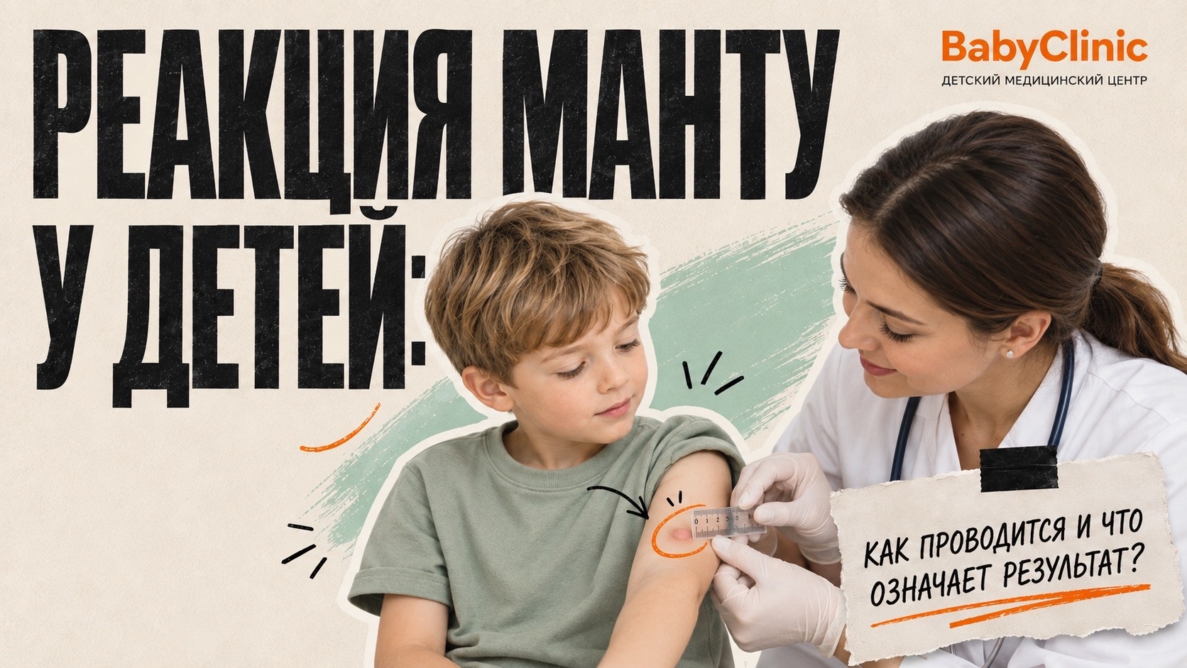 Реакция Манту у детей: как проводится и что означает результат?